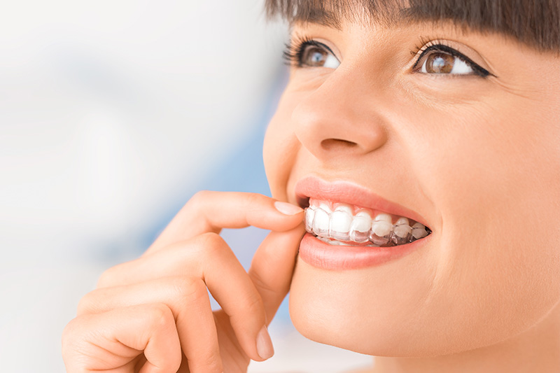 Invisalign in Grapevine